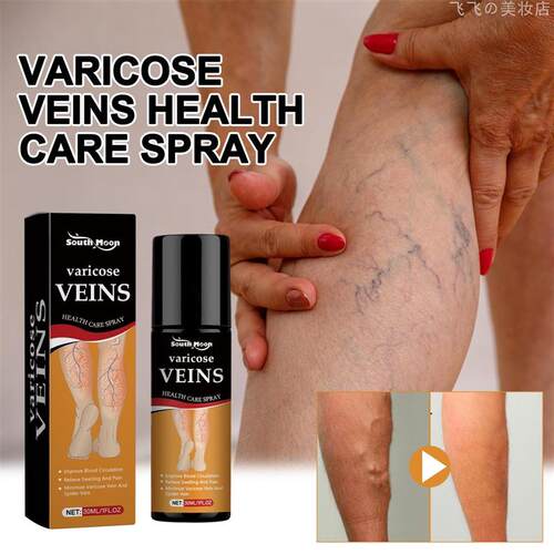 Varicose Veins Cream Varicose Vein Treatment Cream For Legs