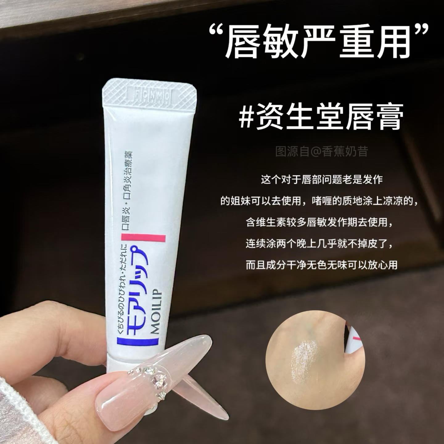 有囤货才安心！资生堂MOILIP口角唇炎修护润唇膏维生素保湿滋8g