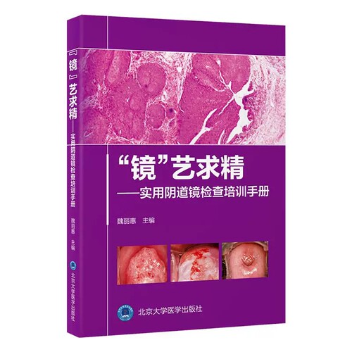 镜艺求精实用阴道镜检查培训手册