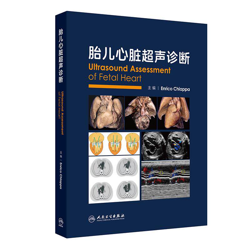 胎儿心脏超声诊断 恩里克 齐阿帕 主编 胎儿心脏超声切面诊断解剖学 胎儿各心脏病心律心跳评估超声诊断技术病例 人民卫生出版社