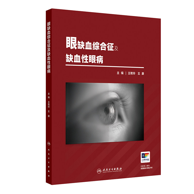 眼缺血综合征及缺血性眼病 王艳玲 王康主编 缺血性视神经病变视网膜静脉阻塞视网膜动脉阻塞睫状后动脉阻塞 人民卫生出版社