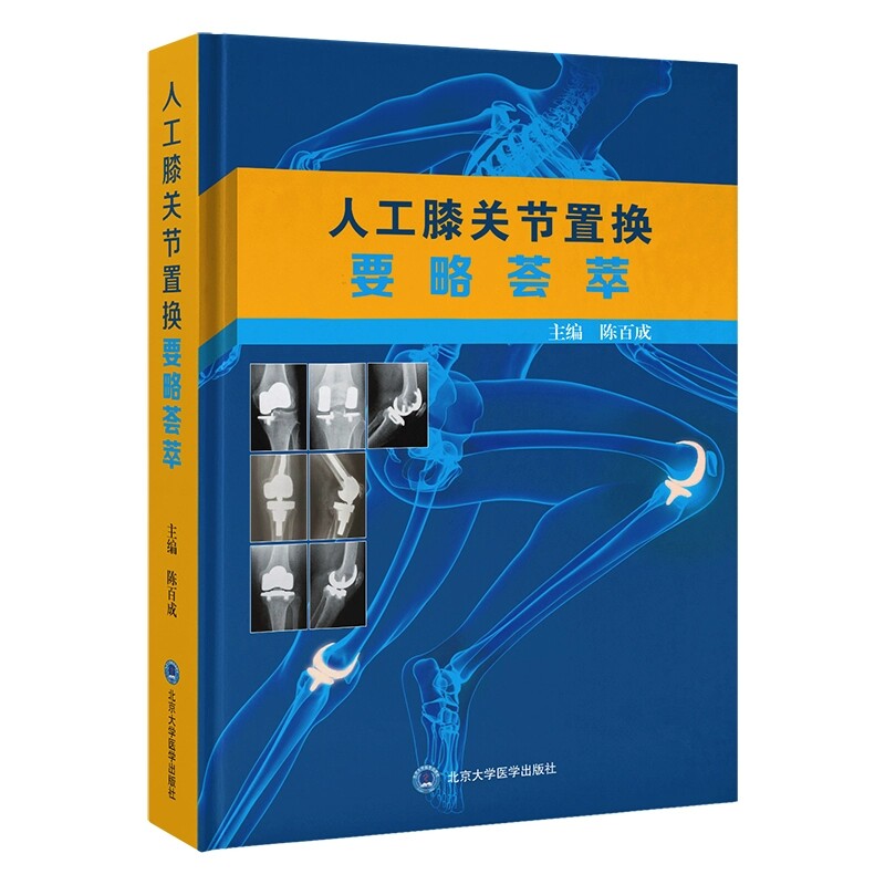 人工膝关节置换要略荟萃