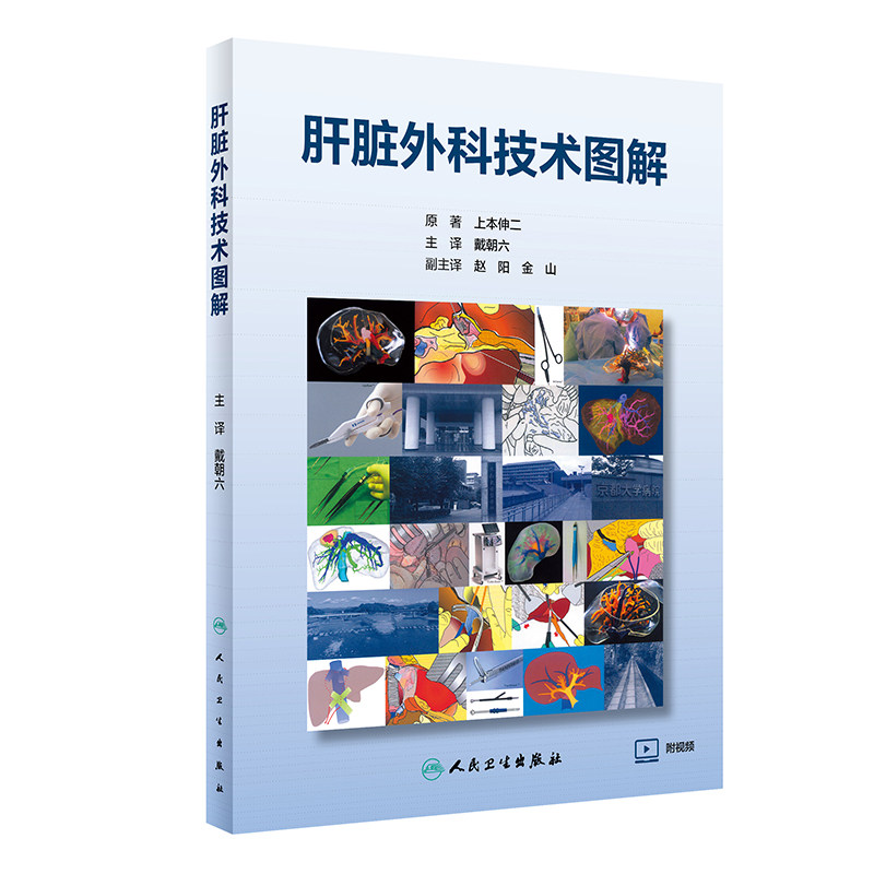 肝脏外科技术图解翻译增值