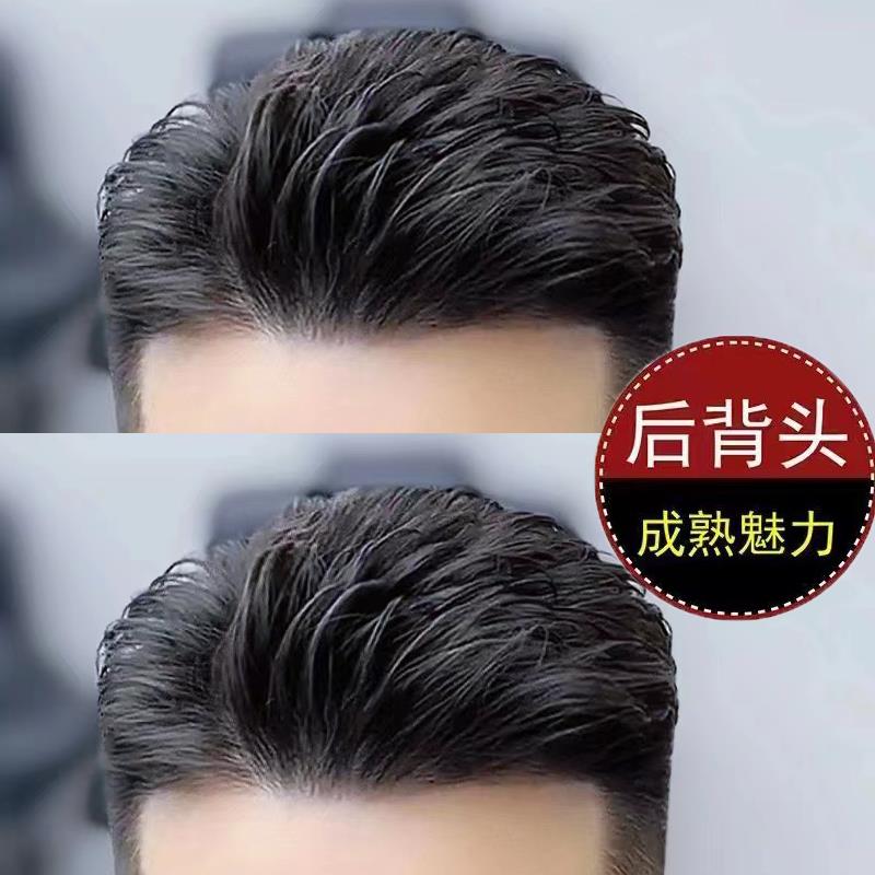 男士假发男大背头头顶补