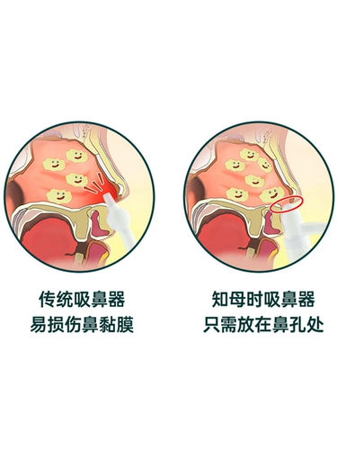 Детский назальный аспиратор для носа от заложенности носа для младенца