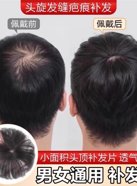 假发片男仿真人发头旋发缝男士补发遮盖伤疤头顶部稀少脱发补发片