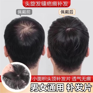 假发片男仿真人发头旋发缝男士补发遮盖伤疤头顶部稀少脱发补发片