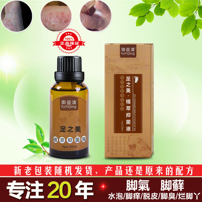 去水泡型止痒脱皮杀菌专用神器脚藓脚痒真菌感染长水泡烂脚丫