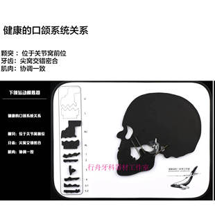 头模颞下颌关节紊乱口颌系统异常演示板TMJ颌垫修复牙科肌肉牙齿