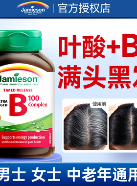 叶酸片维生素b6治中老年h白头发b12男士少白发女黑发转正品旗舰店