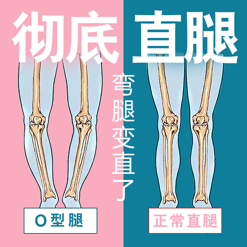 有效矫正腿型 2024推荐直腿神器矫正O型腿XO型腿小腿外翻假胯宽