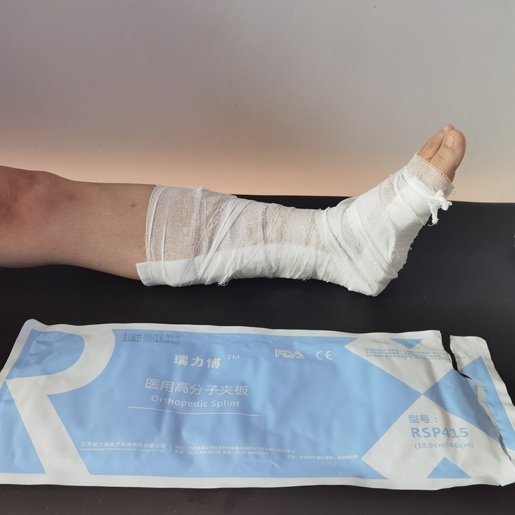 骨折高分子夹板固定石膏绷带脚踝关节手臂小腿膝固定塑形代替石膏