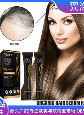 Ball shaped dense hair essential oil for thick and sparse