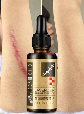 Remove Acne Scars Pregnant woman stretch marks Lavender oils