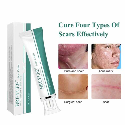 AcneScarRemovalCkipF