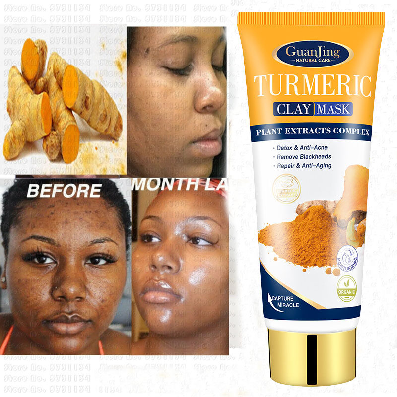 Anti Acne Tumeric Mud Mask Facial Clean Blackhead姜黄面膜泥
