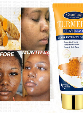 Anti Acne Tumeric Mud Mask Facial Clean Blackhead姜黄面膜泥