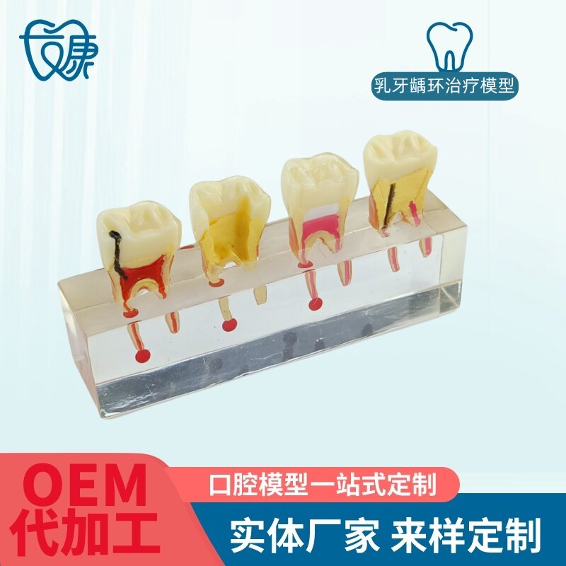 根管牙髓治疗模型牙科口腔教学牙模种植修复病理模型医患沟通模型