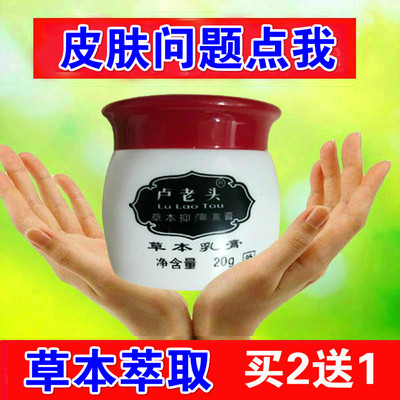 治疗银屑病止去哏专用药膏痒头皮屑癣真菌感染去头藓牛皮癣特效药