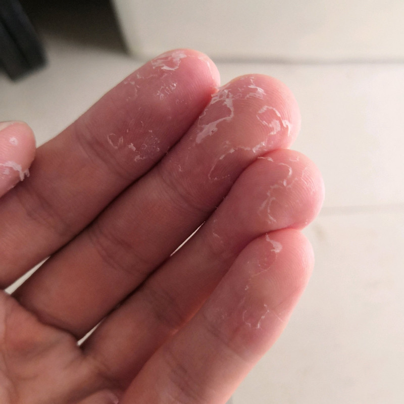 季节性手脱皮药阿膏真菌严24重手掌脱皮专用脚底蜕皮护手霜修复霜