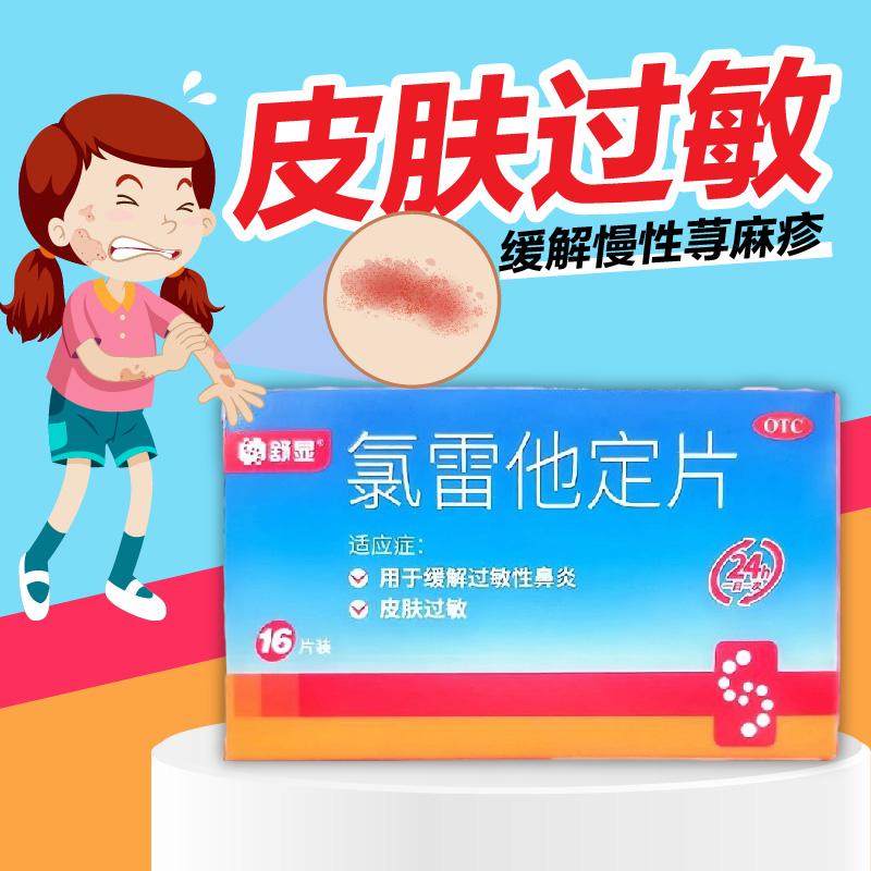 舒显 氯雷他定片 10mg*16片/盒过敏性鼻炎喷嚏流涕鼻痒鼻塞荨麻疹