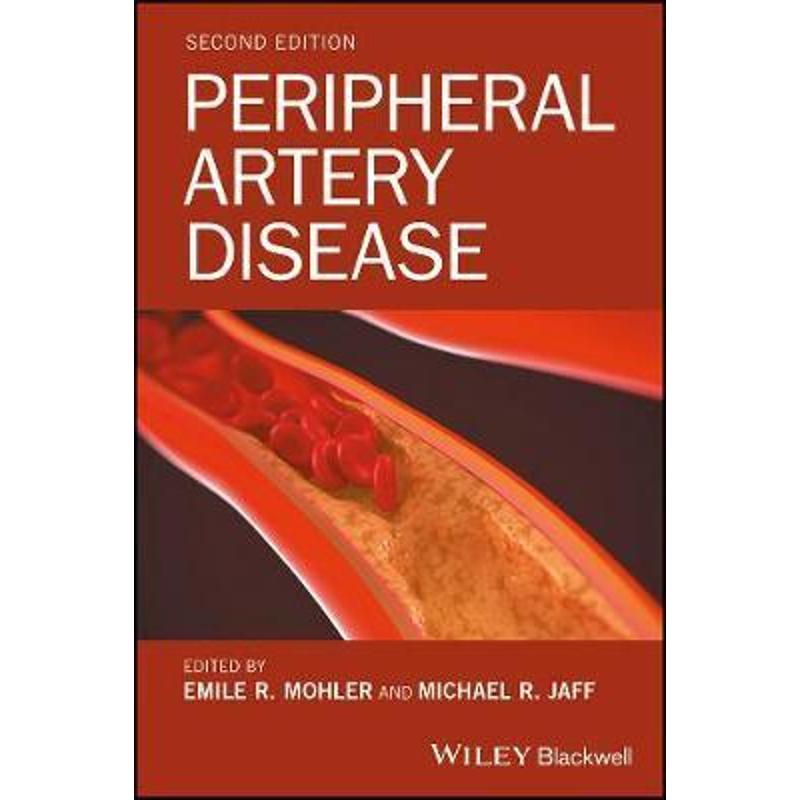 预订，下单后3-4周发货！