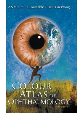 按需印刷Colour Atlas of Ophthalmology[9789812771544]