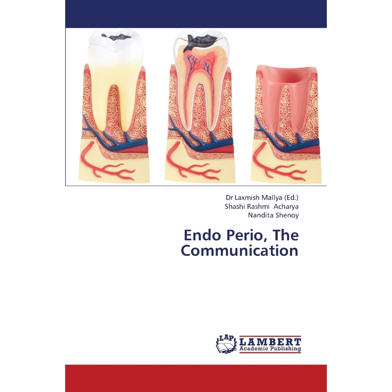 预订，预计下单后2-3周左右发货！