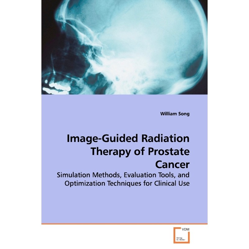按需印刷不退不换Image-Guided Radiation Therapy of Prostate Cancer[9783639153927]