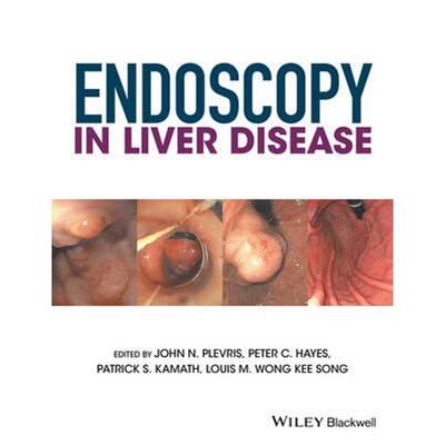 按需印刷不退不换Endoscopy in Liver Disease[9781118660874]