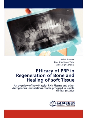 按需印刷Efficacy of Prp in Regeneration of Bone and Healing of Soft Tissue[9783848445974]