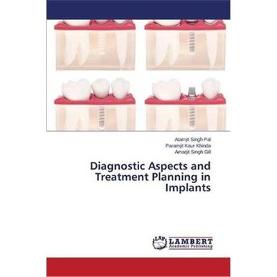 按需印刷Diagnostic Aspects and Treatment Planning in Implants[9783846532584]