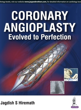 按需印刷Coronary Angioplasty Evolved To Perfection[9789386261960]