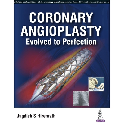 按需印刷Coronary Angioplasty Evolved To Perfection[9789386261960]