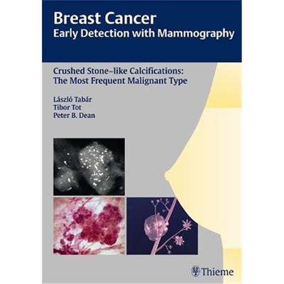 预订Breast Cancer: Early Detection with Mammography:Crushed Stone-like Calcifications: The Most Frequent Malignant Type