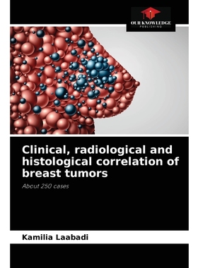 按需印刷Clinical, radiological and histological correlation of breast tumors[9786204046006]