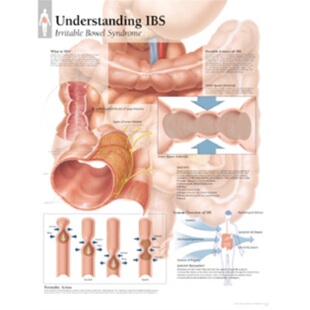 9781930633513 预订Understanding Poster Paper IBS
