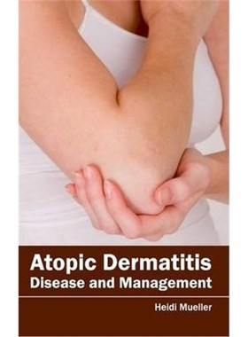 按需印刷Atopic Dermatitis[9781632420589]
