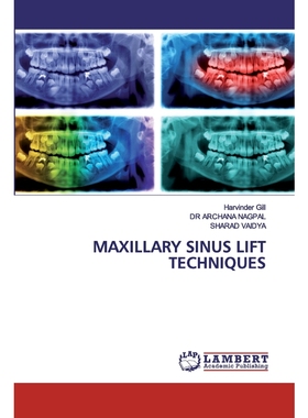 按需印刷MAXILLARY SINUS LIFT TECHNIQUES[9786202524070]