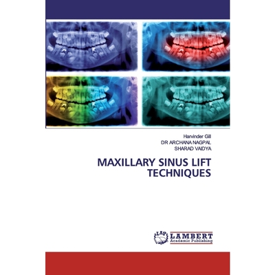按需印刷MAXILLARY SINUS LIFT TECHNIQUES[9786202524070]