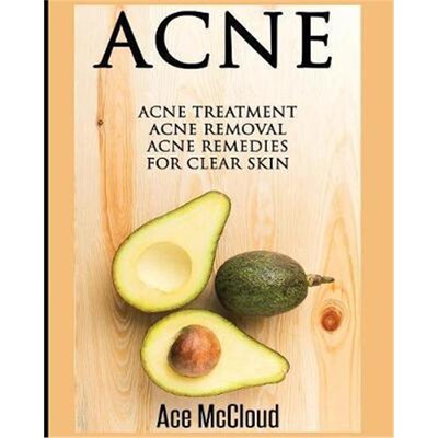 按需印刷不退不换Acne:Acne Treatment: Acne Removal: Acne Remedies For Clear Skin[9781640481268]