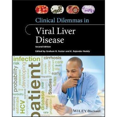 按需印刷Clinical Dilemmas in Viral Liver Disease[9781119533399]