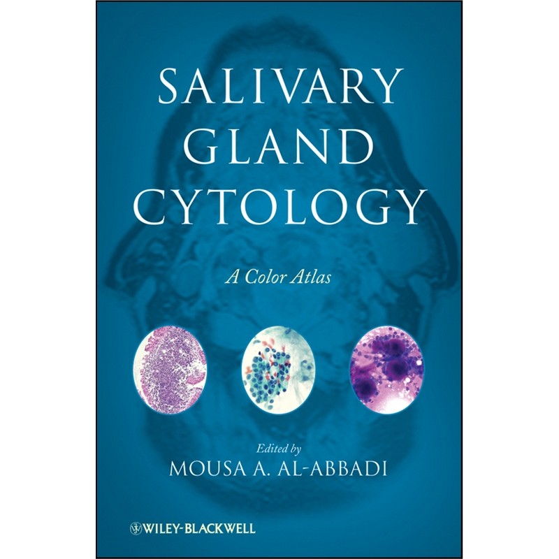 预订salivary gland cytology:a color atlas