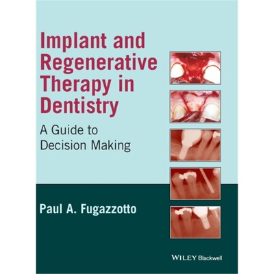 预订Implant and Regenerative Therapy in Dentistry[9780813829623]