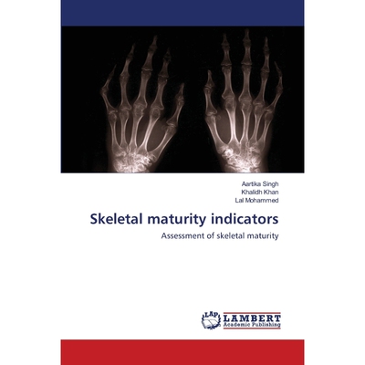 按需印刷Skeletal maturity indicators[9786202670647]