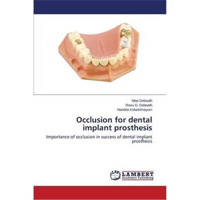 按需印刷Occlusion for Dental Implant Prosthesis[9783659515576]