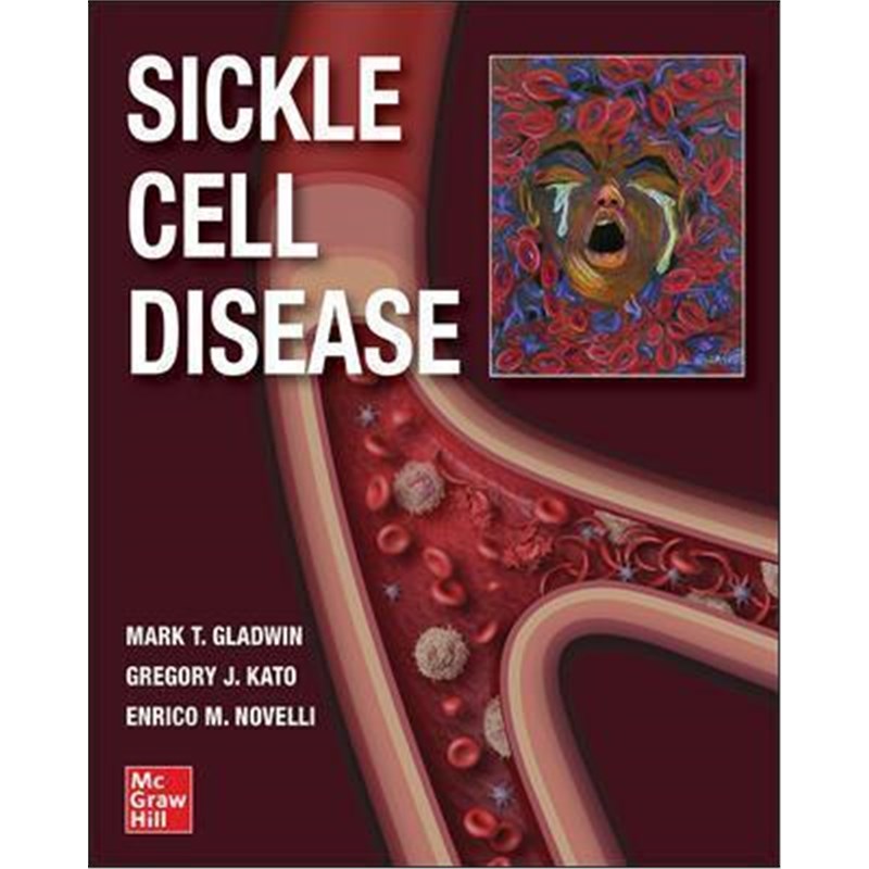 预订，预计下单后3-6周左右发货！