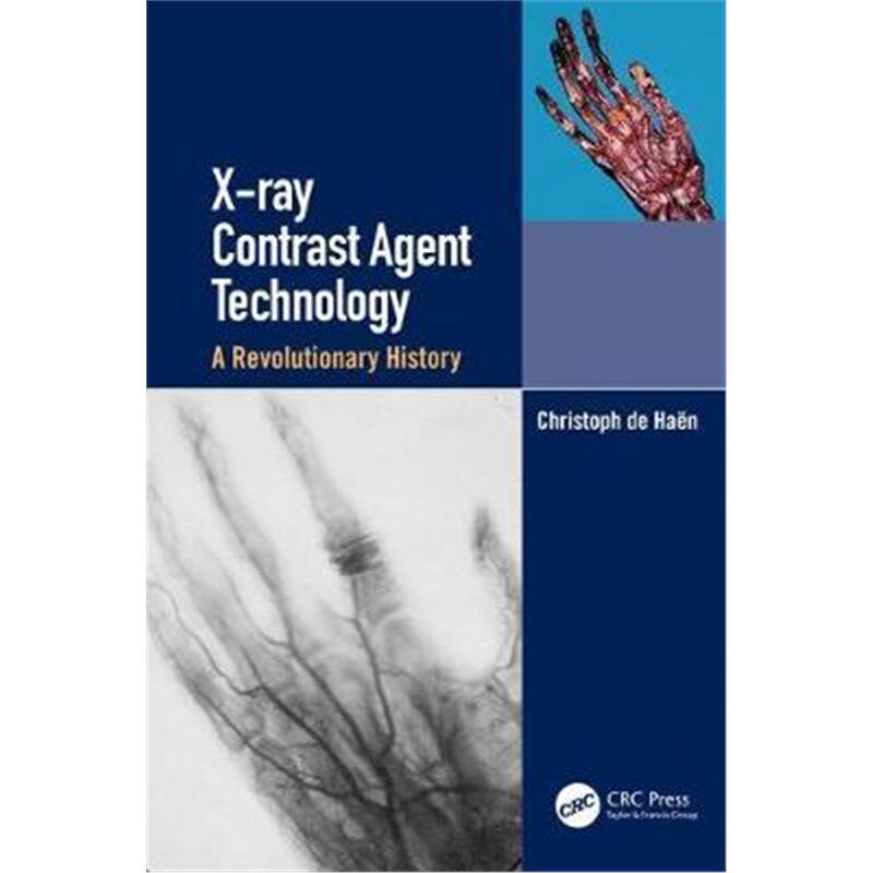 按需印刷不退不换X-ray Contrast Agent Technology:A Revolutionary History[9781138351646]