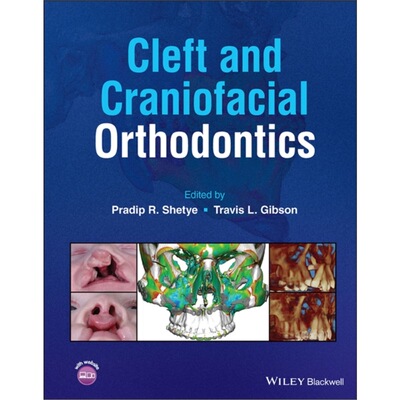 预订Cleft and Craniofacial Orthodontics