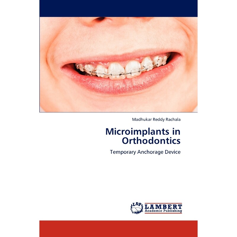 按需印刷不退不换Microimplants in Orthodontics[9783847312062]